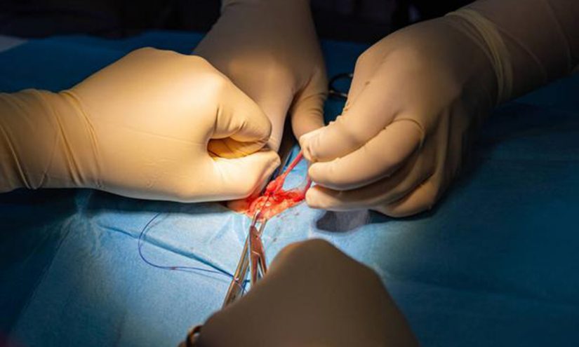 Favorire la donazione organi