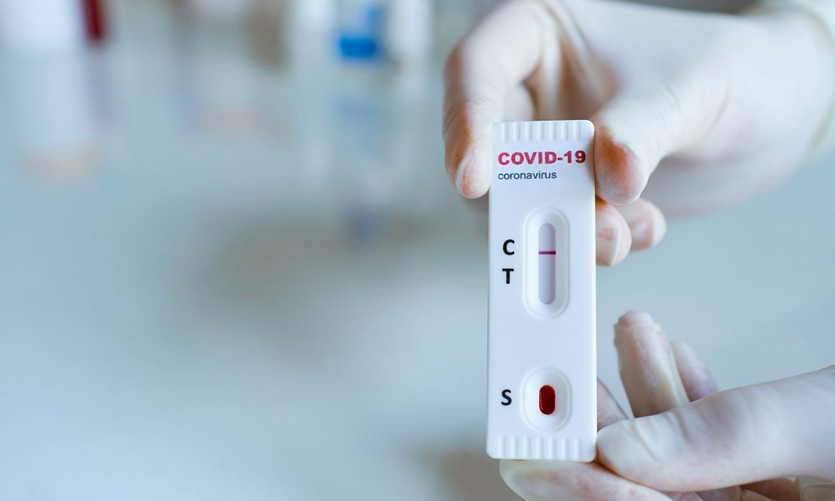Test sierologico Covid