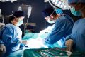 Donazione organi