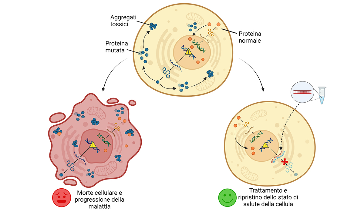 Sla - sclerosi laterale amiotrofica