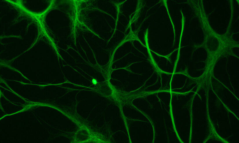 Cellule cerebrali